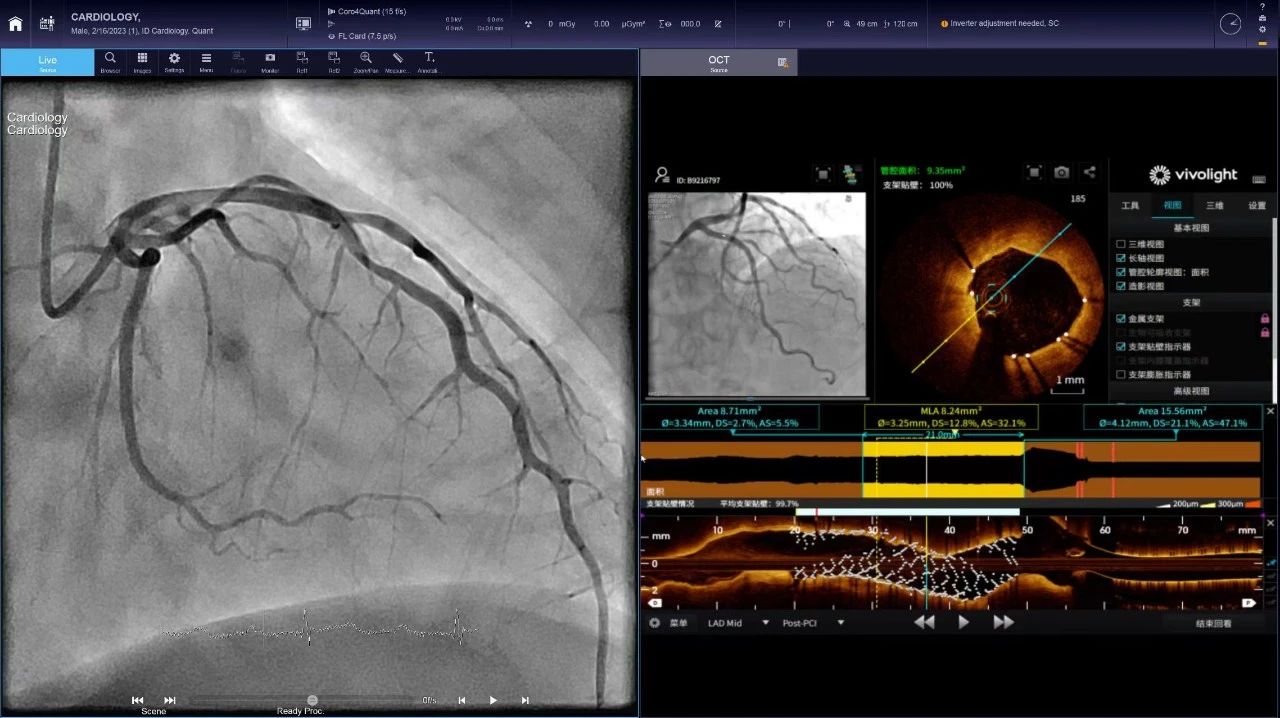 微信圖片_20241119143443.jpg 微信圖片_20241119143443.jpg